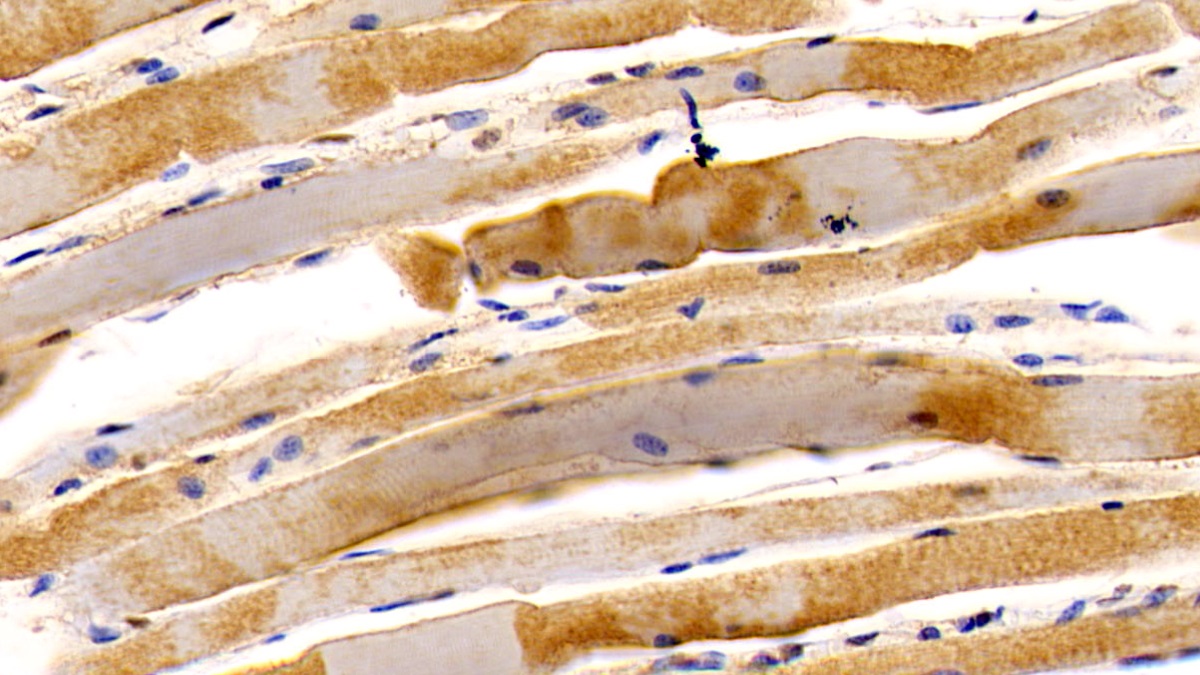 Monoclonal Antibody to Osteocalcin (OC)