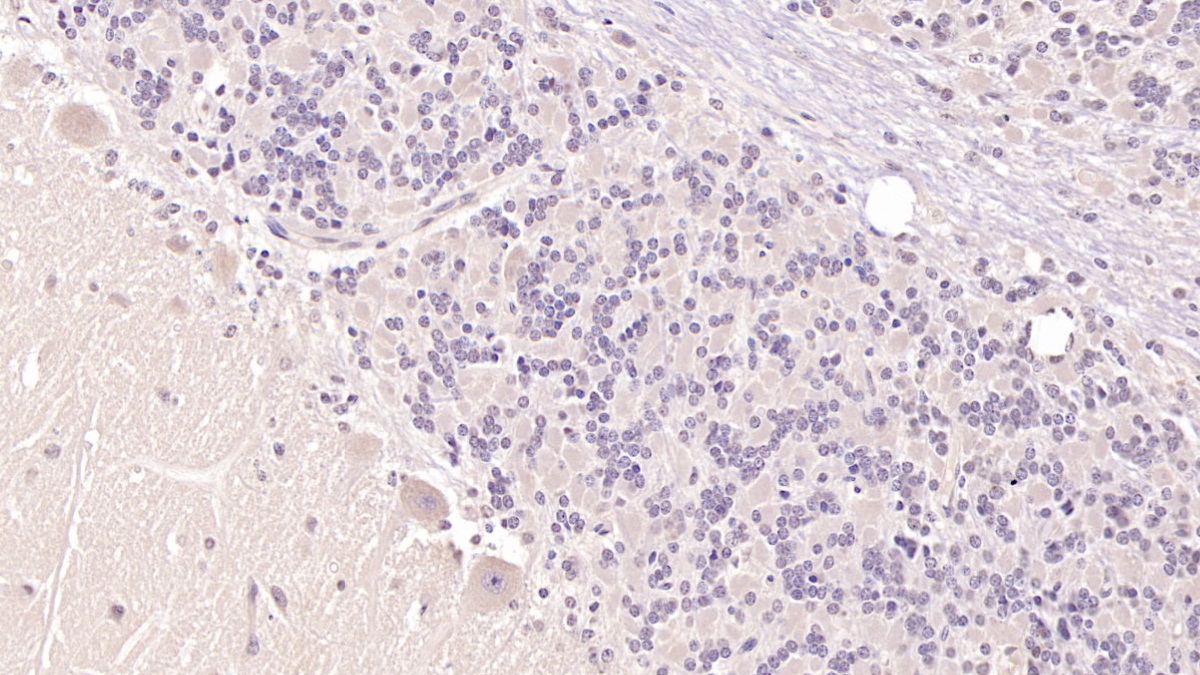 Monoclonal Antibody to Parathyroid Hormone Receptor 2 (PTHR2)