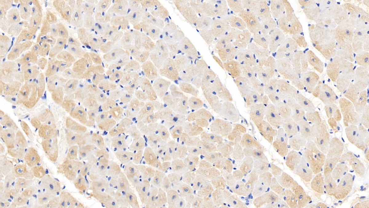 Monoclonal Antibody to Cardiac Troponin I (cTnI)