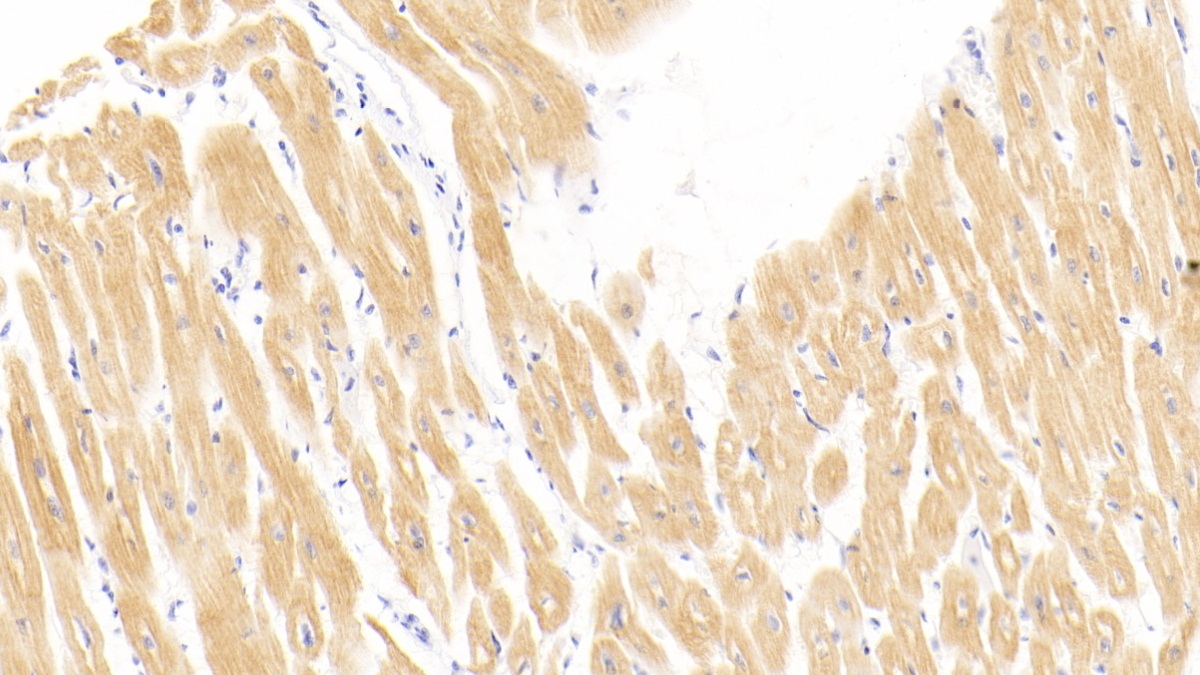 Monoclonal Antibody to Cardiac Troponin I (cTnI)