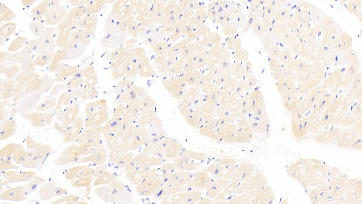 Monoclonal Antibody to Cardiac Troponin I (cTnI)