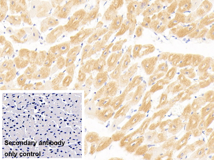 Monoclonal Antibody to Cardiac Troponin I (cTnI)