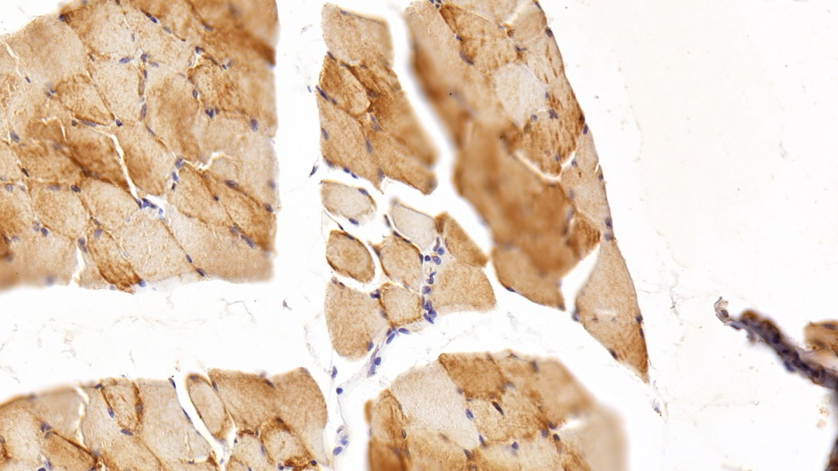 Monoclonal Antibody to Myoglobin (MYO)