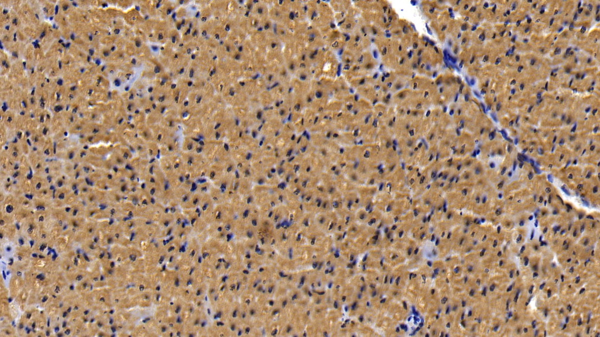 Monoclonal Antibody to Myoglobin (MYO)