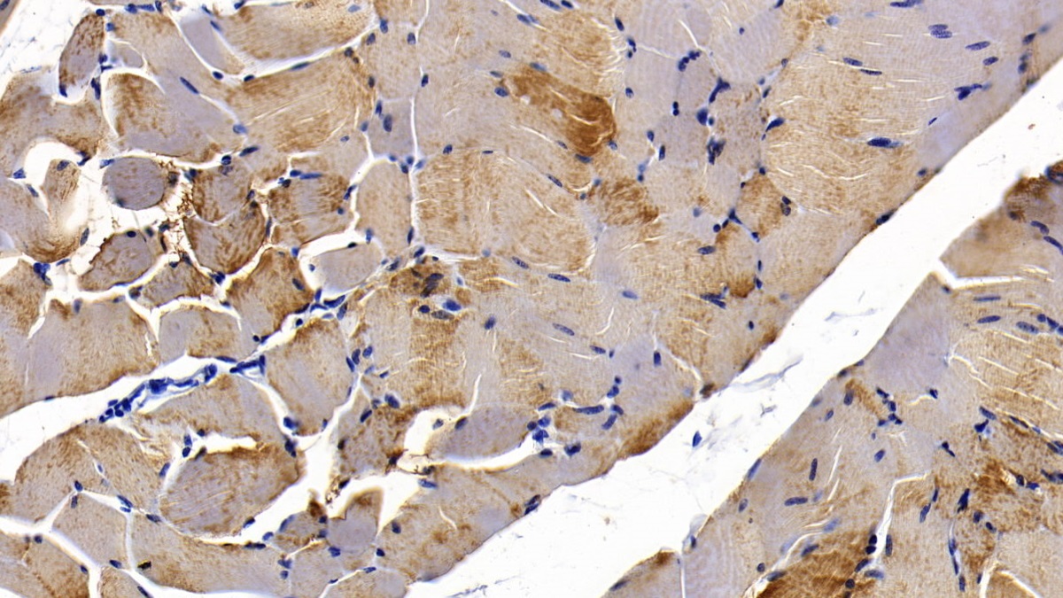 Monoclonal Antibody to Myoglobin (MYO)