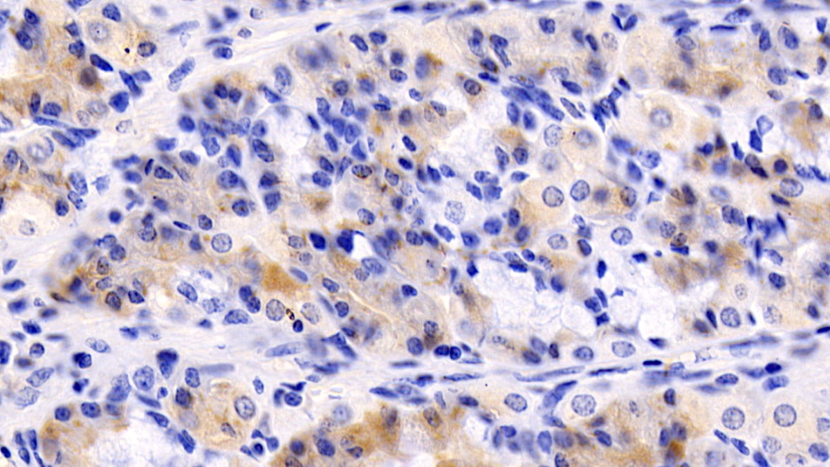 Monoclonal Antibody to N-Terminal Pro-Atrial Natriuretic Peptide (NT-ProANP)