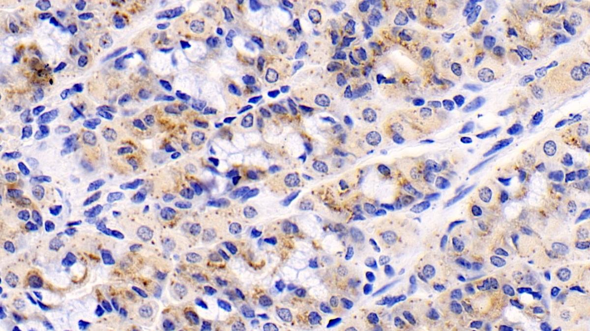 Monoclonal Antibody to N-Terminal Pro-Atrial Natriuretic Peptide (NT-ProANP)