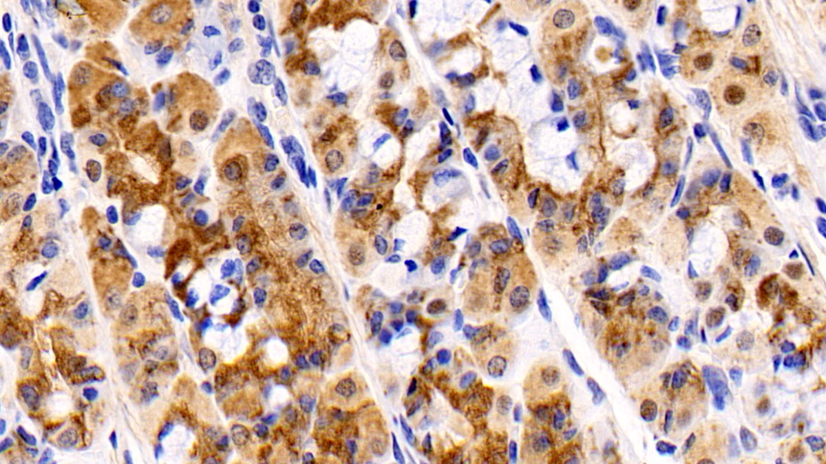 Monoclonal Antibody to N-Terminal Pro-Atrial Natriuretic Peptide (NT-ProANP)