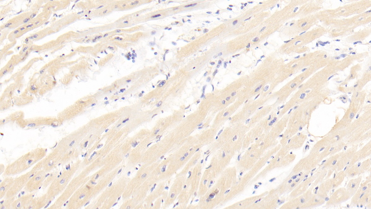 Monoclonal Antibody to N-Terminal Pro-Brain Natriuretic Peptide (NT-ProBNP)