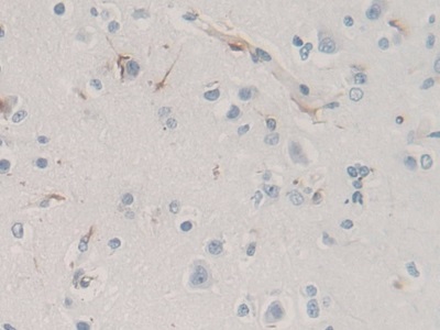 Monoclonal Antibody to Nestin (NES)