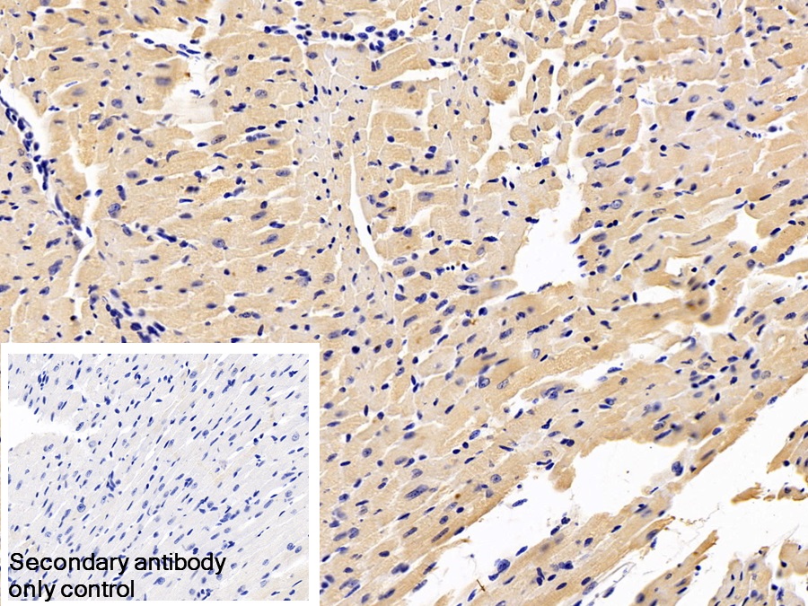 Monoclonal Antibody to Natriuretic Peptide Precursor B (NPPB)