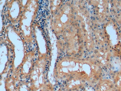 Monoclonal Antibody to Apolipoprotein A1 (APOA1)