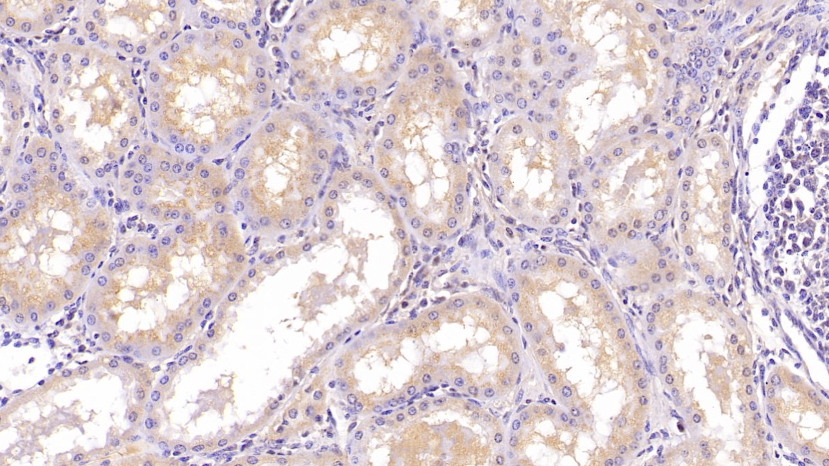 Monoclonal Antibody to Apolipoprotein A1 (APOA1)