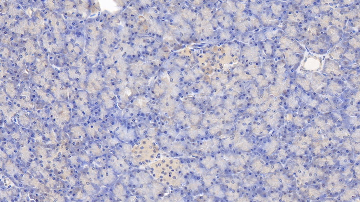 Monoclonal Antibody to Tissue Factor (TF)