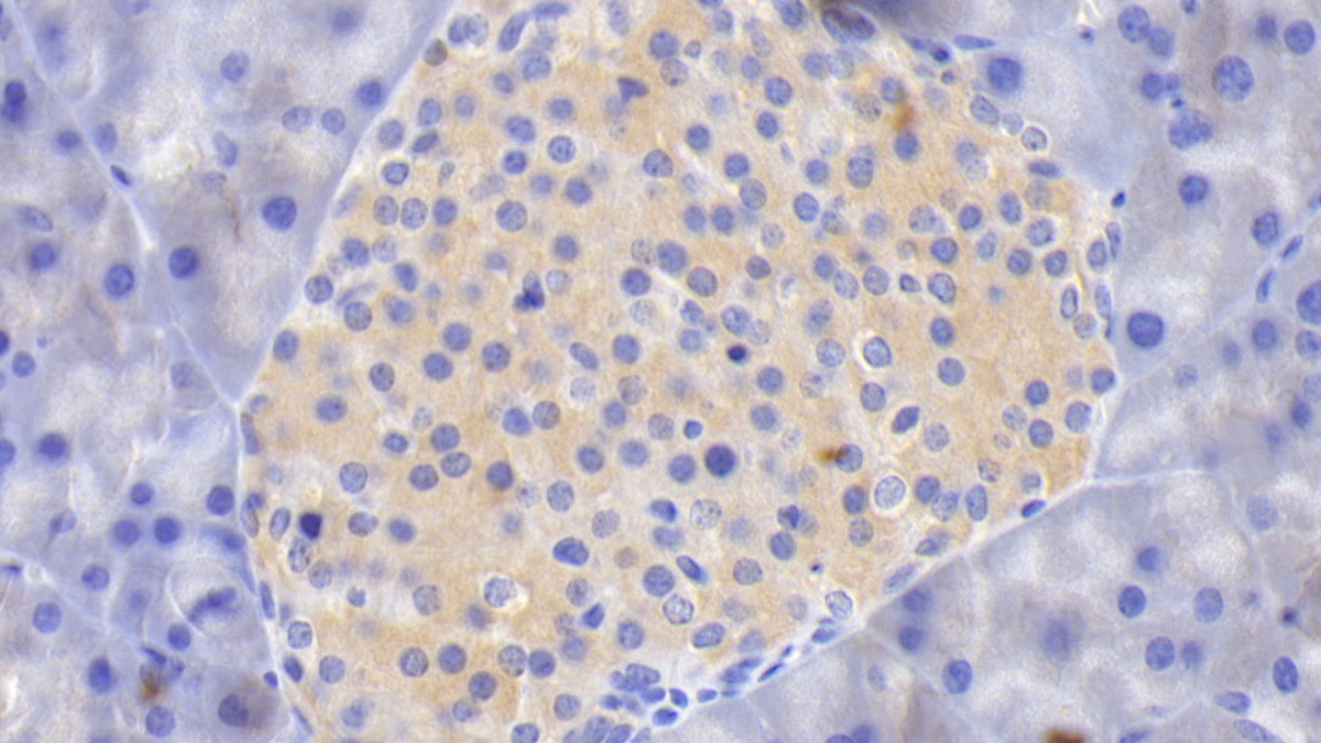 Monoclonal Antibody to Tissue Factor (TF)