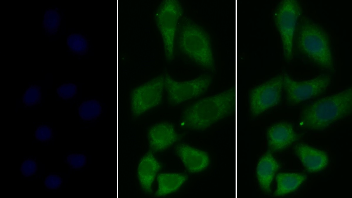 Monoclonal Antibody to Tissue Plasminogen Activator (tPA)