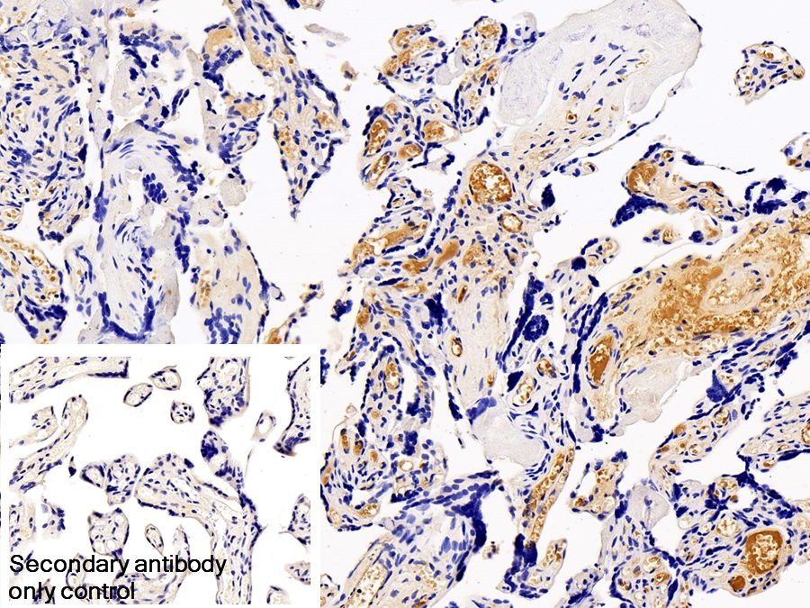 Monoclonal Antibody to Tissue Plasminogen Activator (tPA)