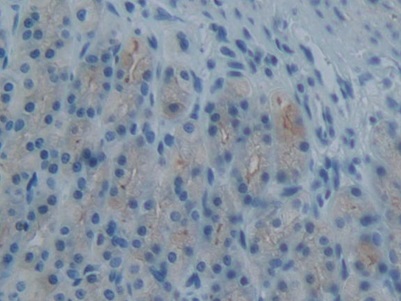 Monoclonal Antibody to Plasminogen Activator Inhibitor 2 (PAI2)