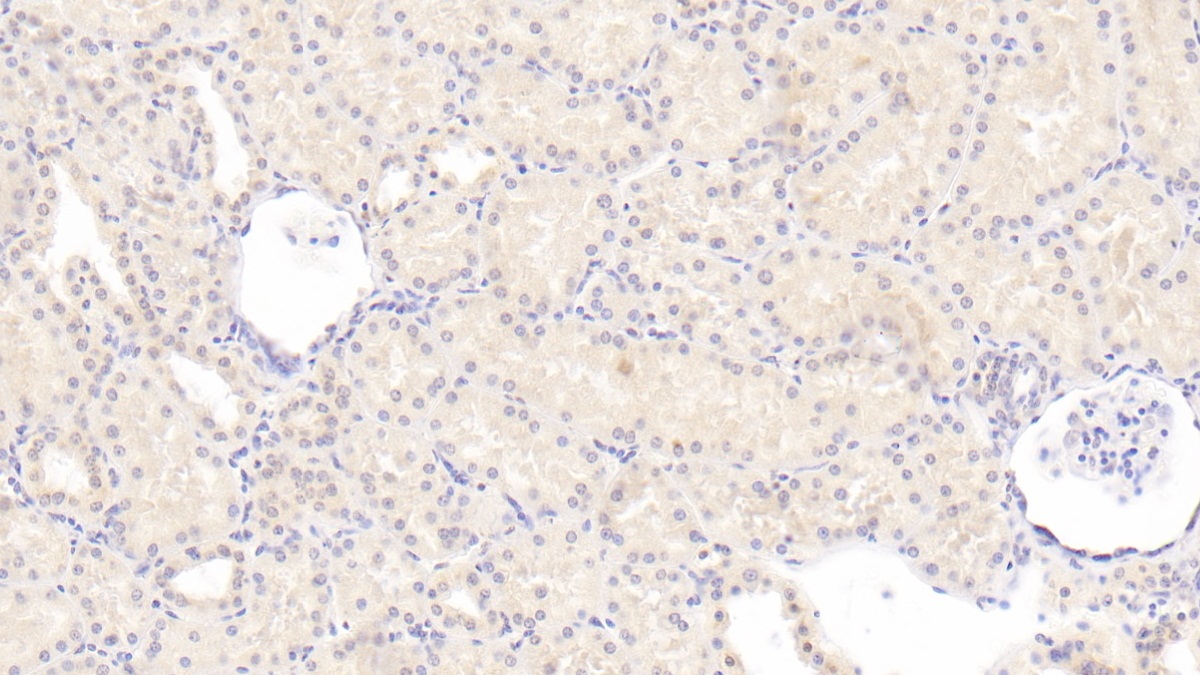 Monoclonal Antibody to Plasminogen Activator Inhibitor 1 (PAI1)