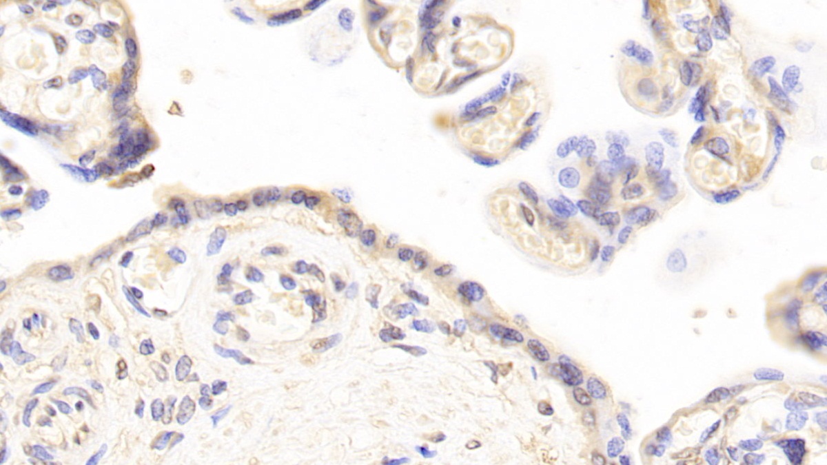 Monoclonal Antibody to Plasminogen Activator Inhibitor 1 (PAI1)