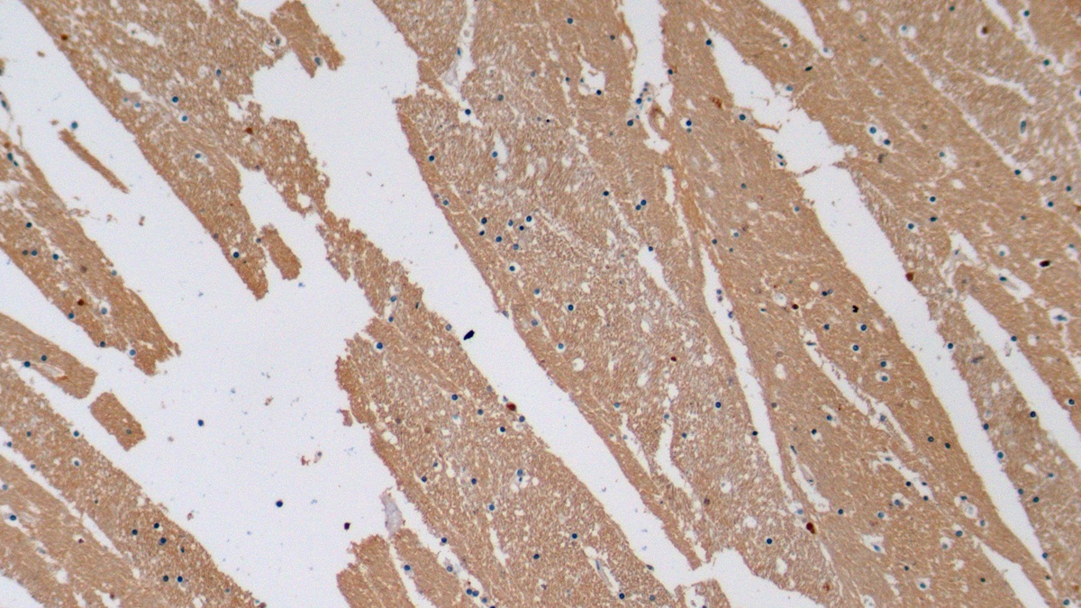 Monoclonal Antibody to Enolase, Neuron Specific (NSE)