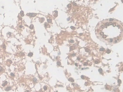 Monoclonal Antibody to Enolase, Neuron Specific (NSE)