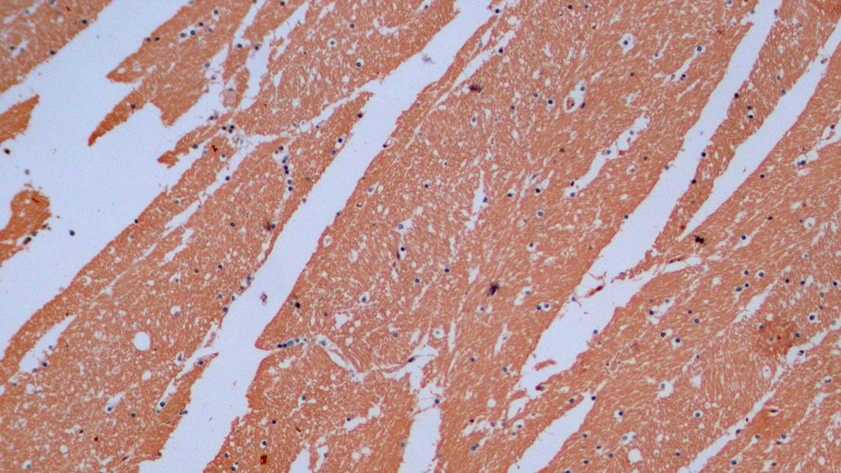 Monoclonal Antibody to Myelin Basic Protein (MBP)