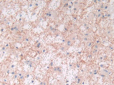 Monoclonal Antibody to Brain Natriuretic Peptide (BNP)