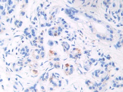 Monoclonal Antibody to Brain Natriuretic Peptide (BNP)