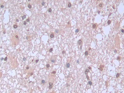 Monoclonal Antibody to Brain Natriuretic Peptide (BNP)