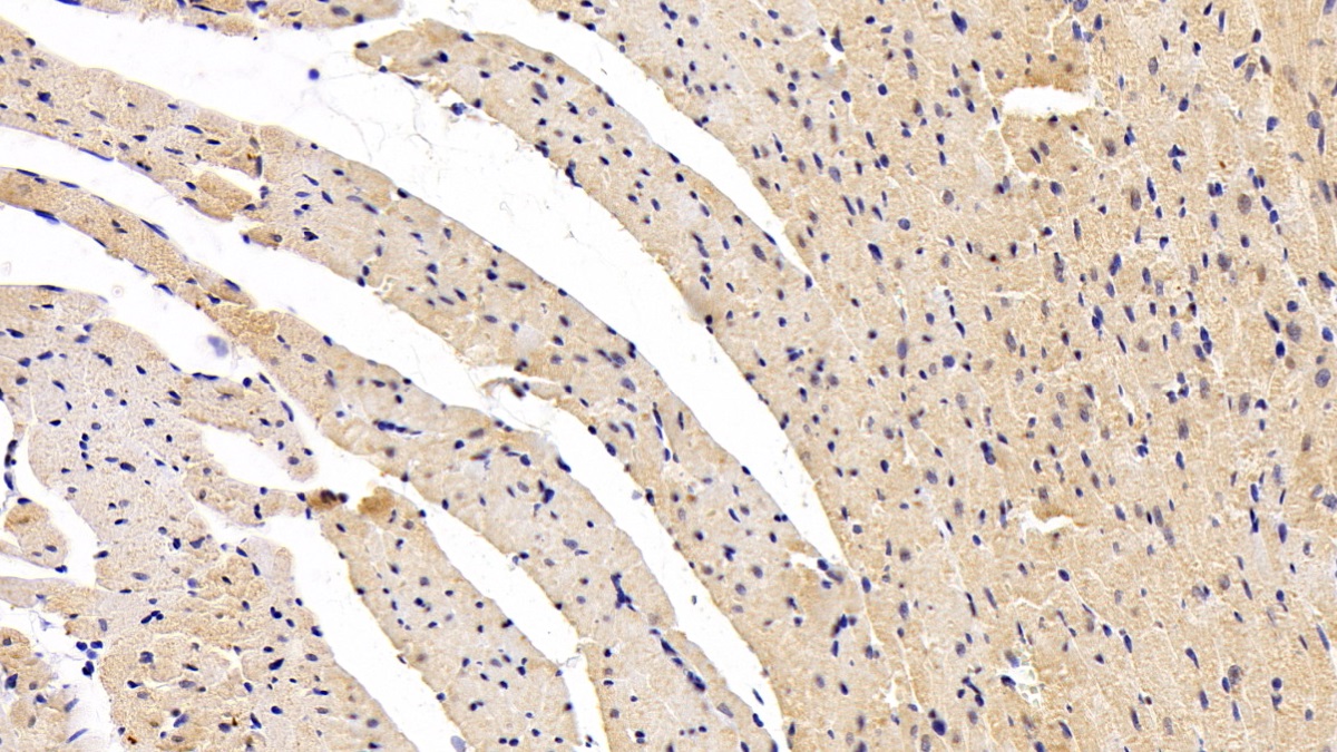 Monoclonal Antibody to Brain Natriuretic Peptide (BNP)