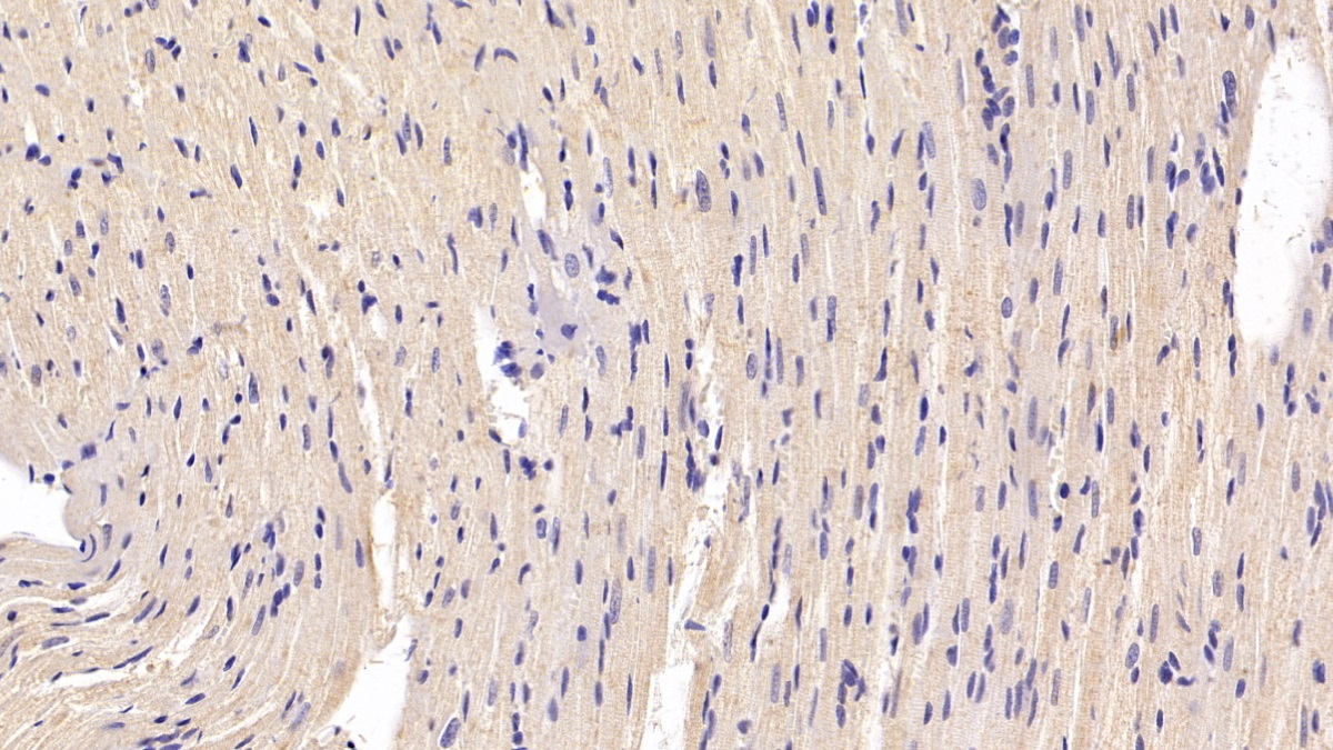 Monoclonal Antibody to Brain Natriuretic Peptide (BNP)