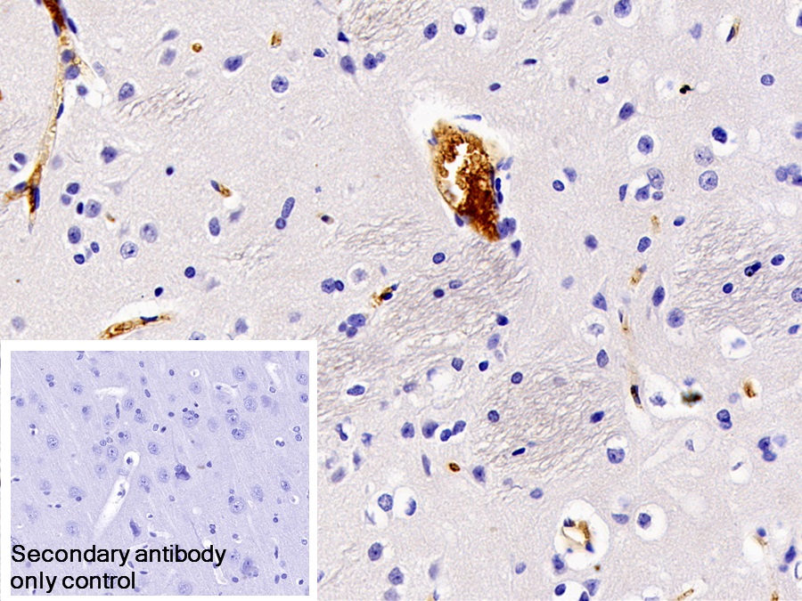 Monoclonal Antibody to Immunoglobulin G (IgG)