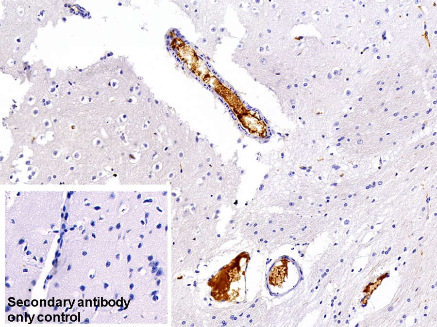 Monoclonal Antibody to Immunoglobulin G (IgG)