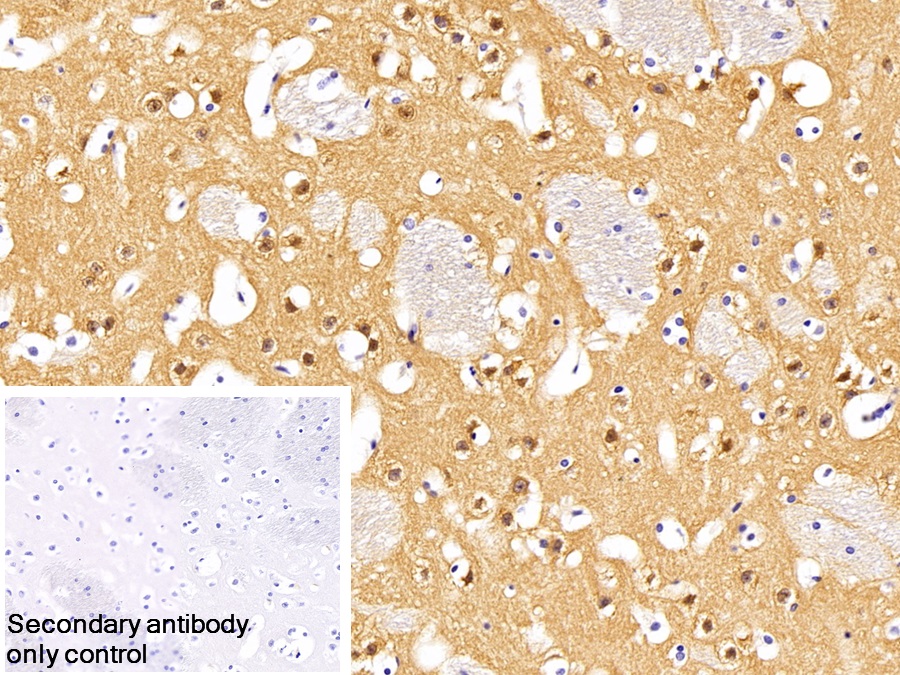 Monoclonal Antibody to Immunoglobulin G (IgG)