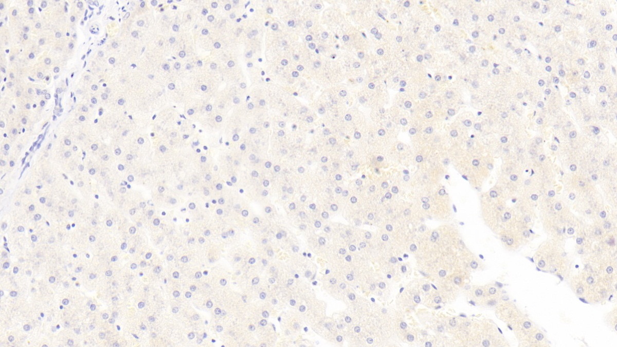 Monoclonal Antibody to Tissue Inhibitors Of Metalloproteinase 1 (TIMP1)