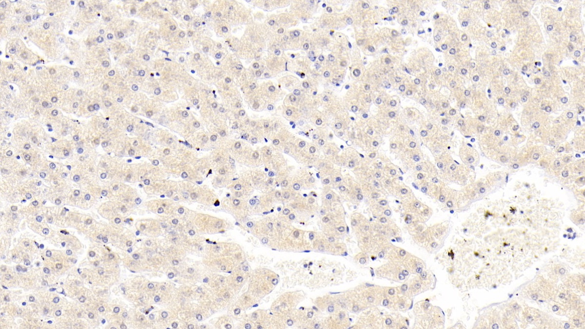 Monoclonal Antibody to Tissue Inhibitors Of Metalloproteinase 1 (TIMP1)