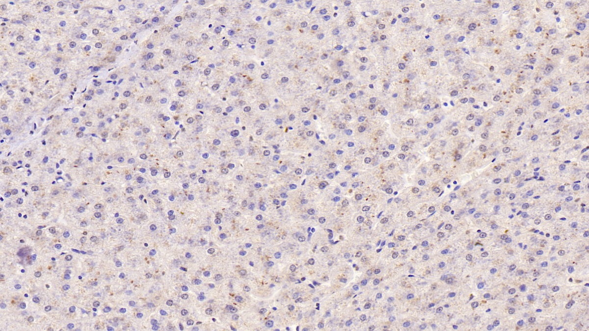 Monoclonal Antibody to Tissue Inhibitors Of Metalloproteinase 1 (TIMP1)