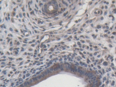 Monoclonal Antibody to Matrix Metalloproteinase 9 (MMP9)