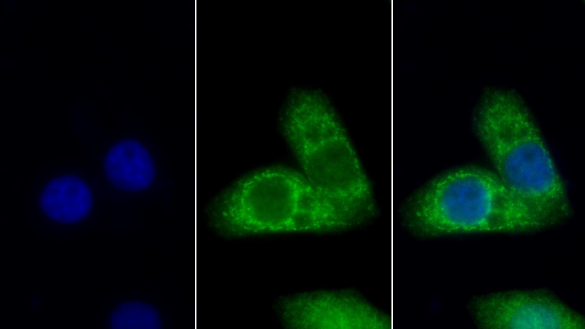 Monoclonal Antibody to Cytokeratin 7 (CK7)