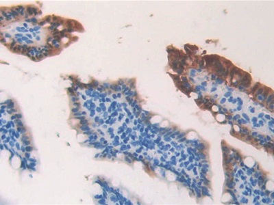 Monoclonal Antibody to Fatty Acid Binding Protein 2, Intestinal (FABP2)