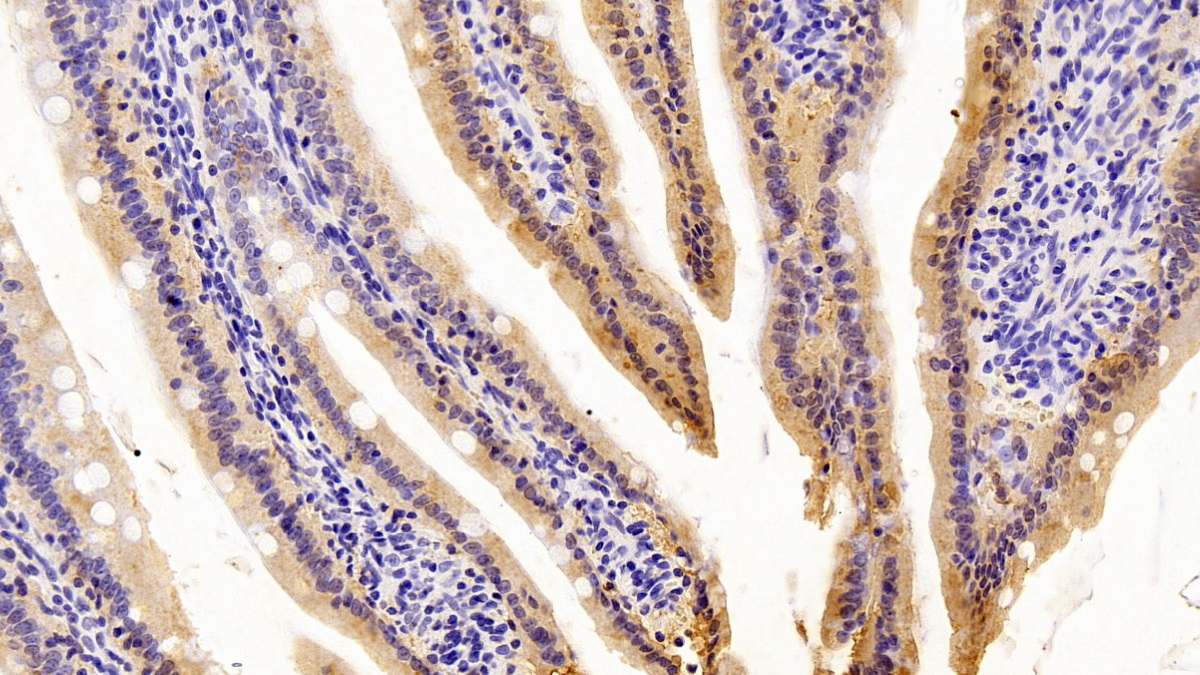 Monoclonal Antibody to Fatty Acid Binding Protein 2, Intestinal (FABP2)