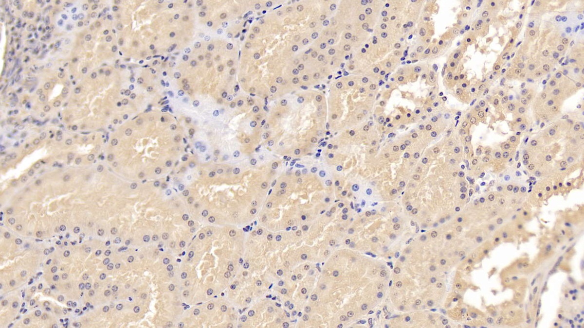 Monoclonal Antibody to Epidermal Growth Factor (EGF)