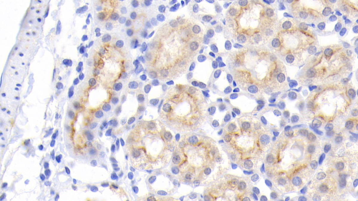 Monoclonal Antibody to Epidermal Growth Factor (EGF)