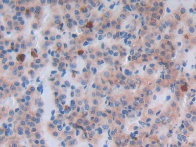 Monoclonal Antibody to Epidermal Growth Factor (EGF)