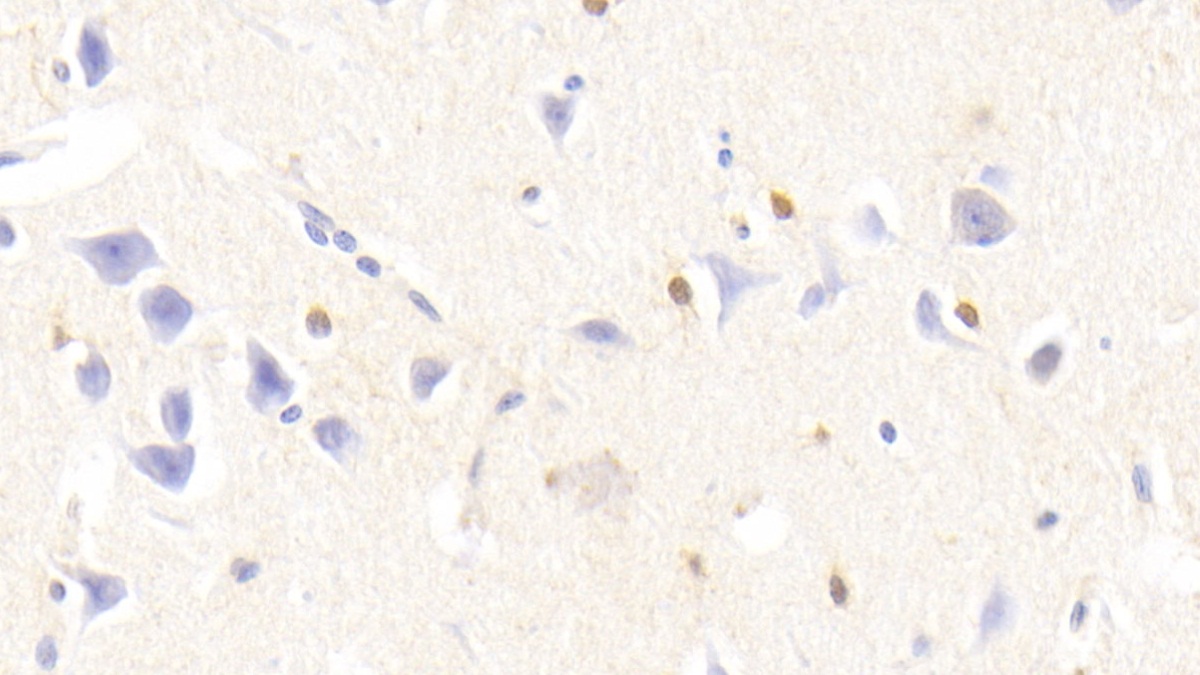 Monoclonal Antibody to S100 Calcium Binding Protein B (S100B)