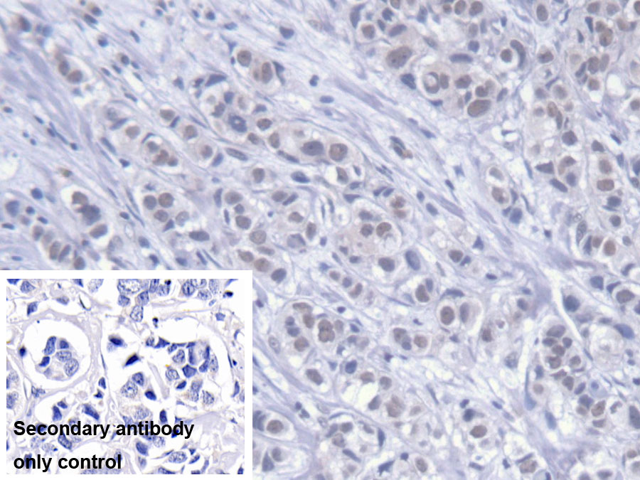 Monoclonal Antibody to S100 Calcium Binding Protein B (S100B)