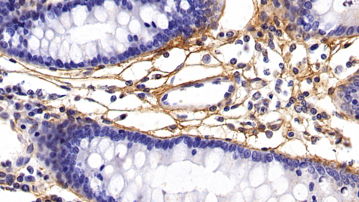 Monoclonal Antibody to Procollagen III N-Terminal Propeptide (PIIINP)