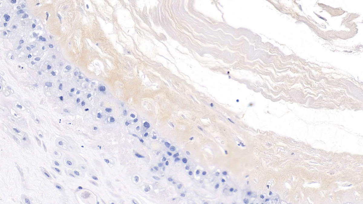 Monoclonal Antibody to Procollagen III N-Terminal Propeptide (PIIINP)