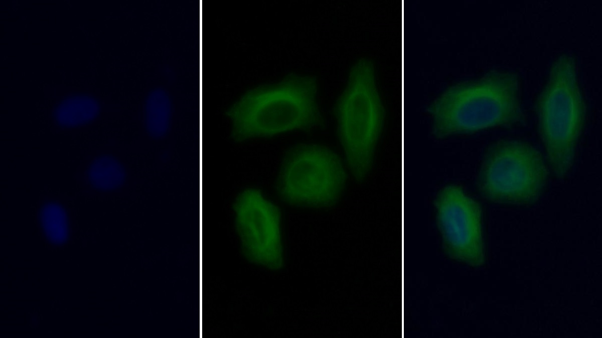 Monoclonal Antibody to Procollagen III N-Terminal Propeptide (PIIINP)